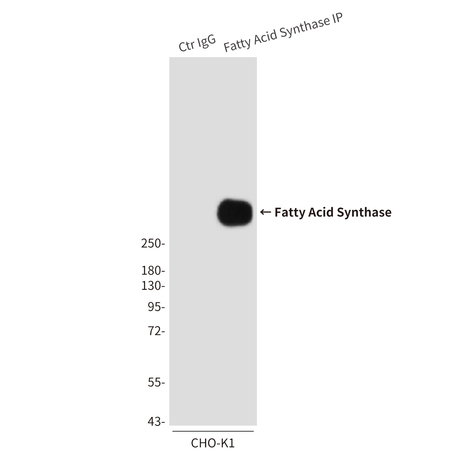 Fatty Acid Synthase Mouse Monoclonal Antibody
