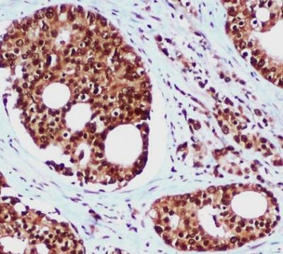 HHR23B Mouse Monoclonal Antibody
