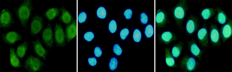 RPA1 Antibody