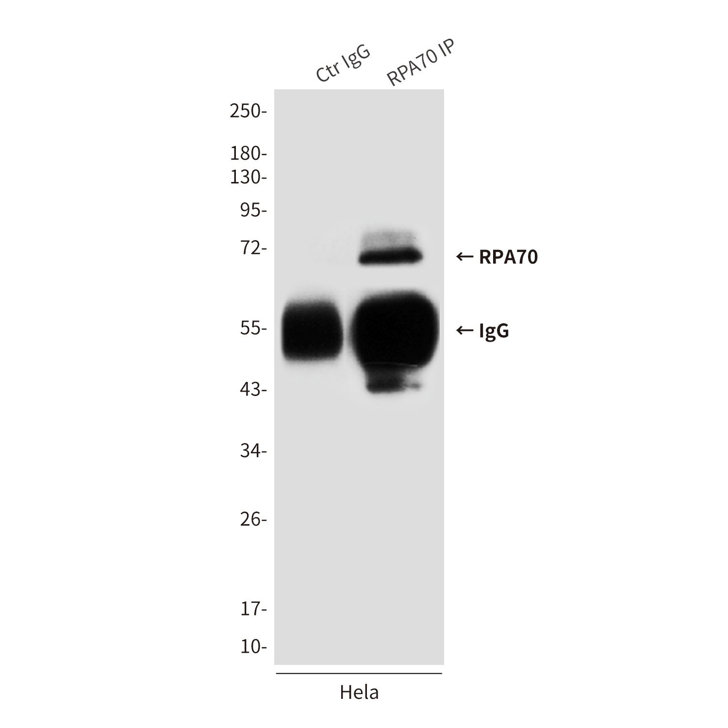 RPA1 Antibody