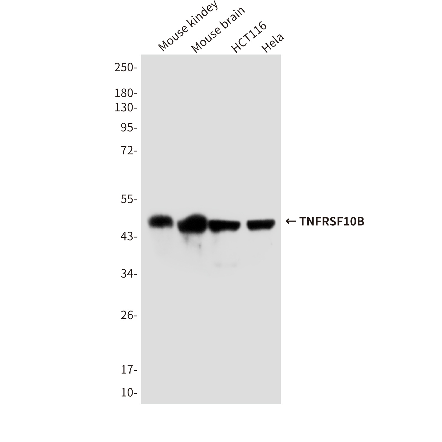 TNFRSF10B (7F4) Mouse mAb