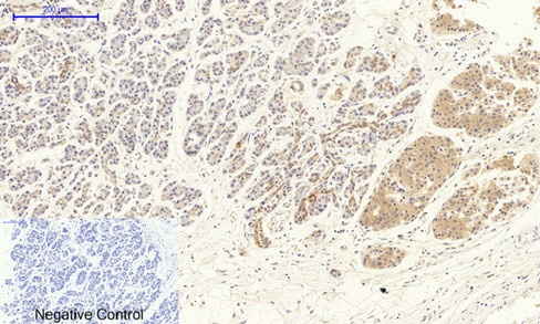 VEGF Receptor 2 Rabbit pAb