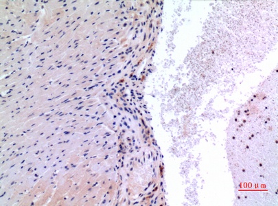 VEGFC Rabbit Polyclonal Antibody
