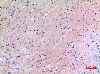 VEGFC Rabbit Polyclonal Antibody