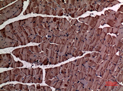 Alpha Smooth Muscle Actin Rabbit Polyclonal Antibody