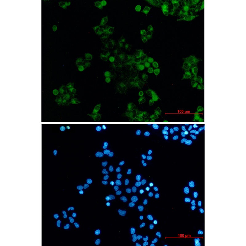 DAB2 Rabbit mAb