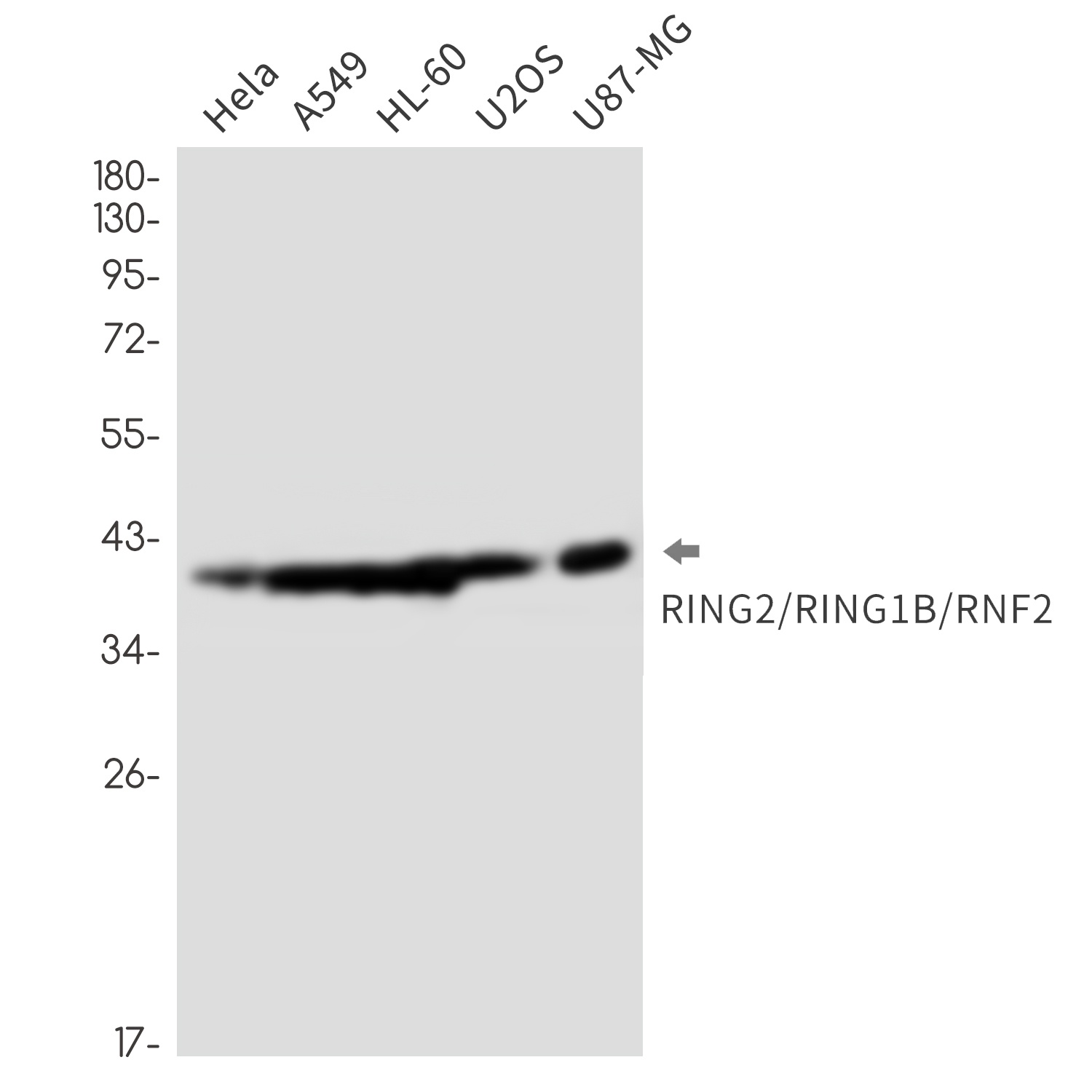 RING2/RING1B/RNF2 Rabbit Monoclonal Antibody
