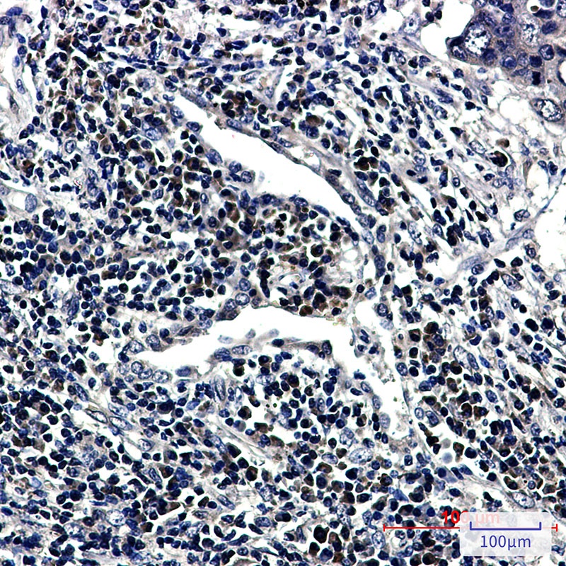 RING2/RING1B/RNF2 Rabbit Monoclonal Antibody