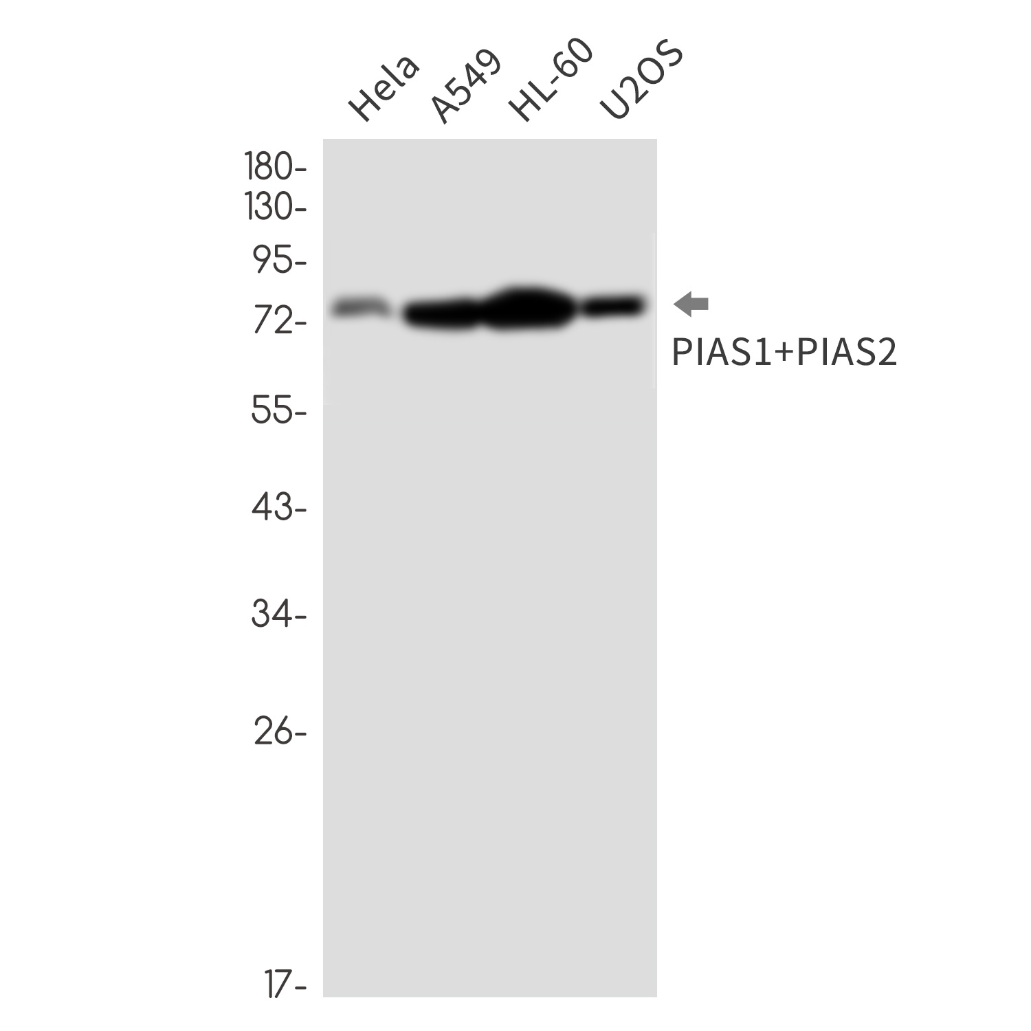 PIAS1/PIAS2/PIAS3 Antibody