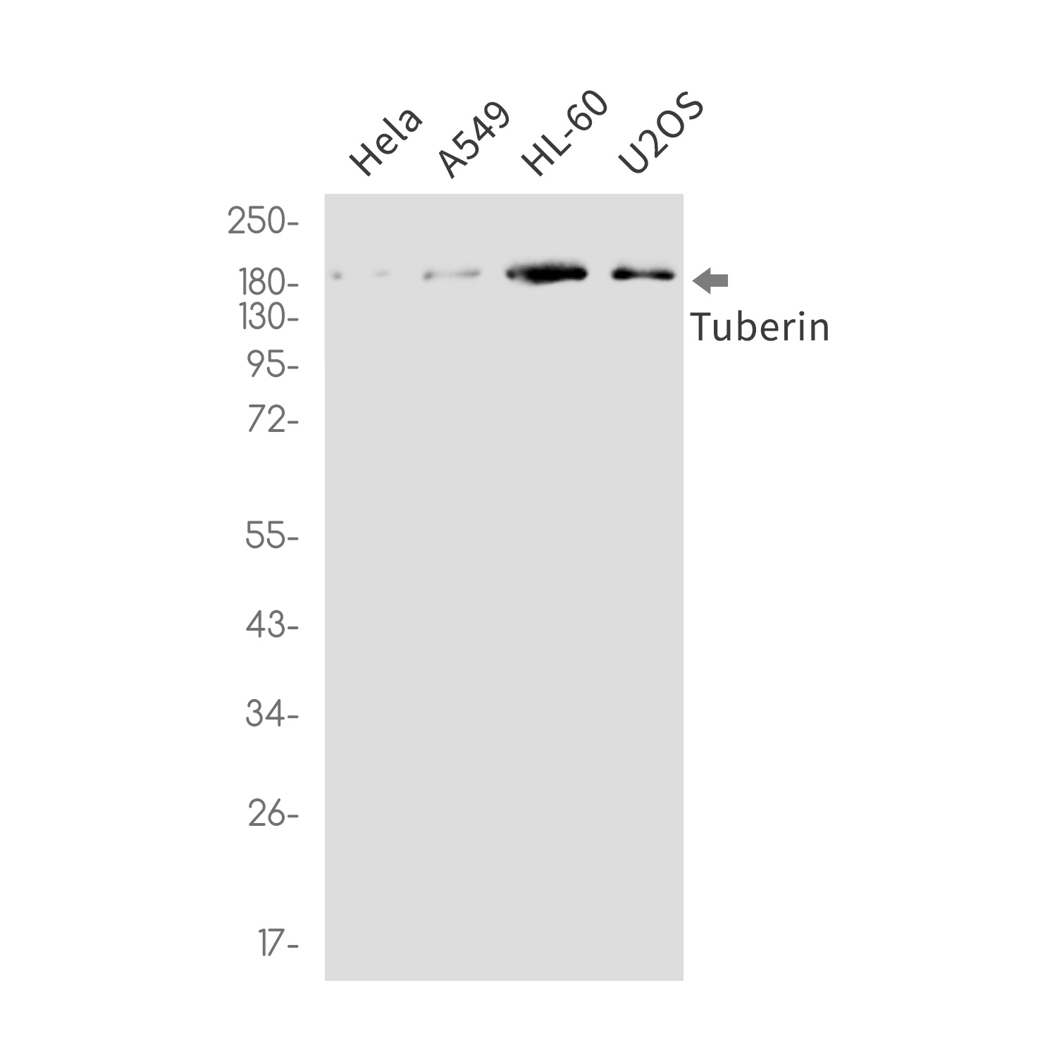 [KO] Tuberin Rabbit mAb