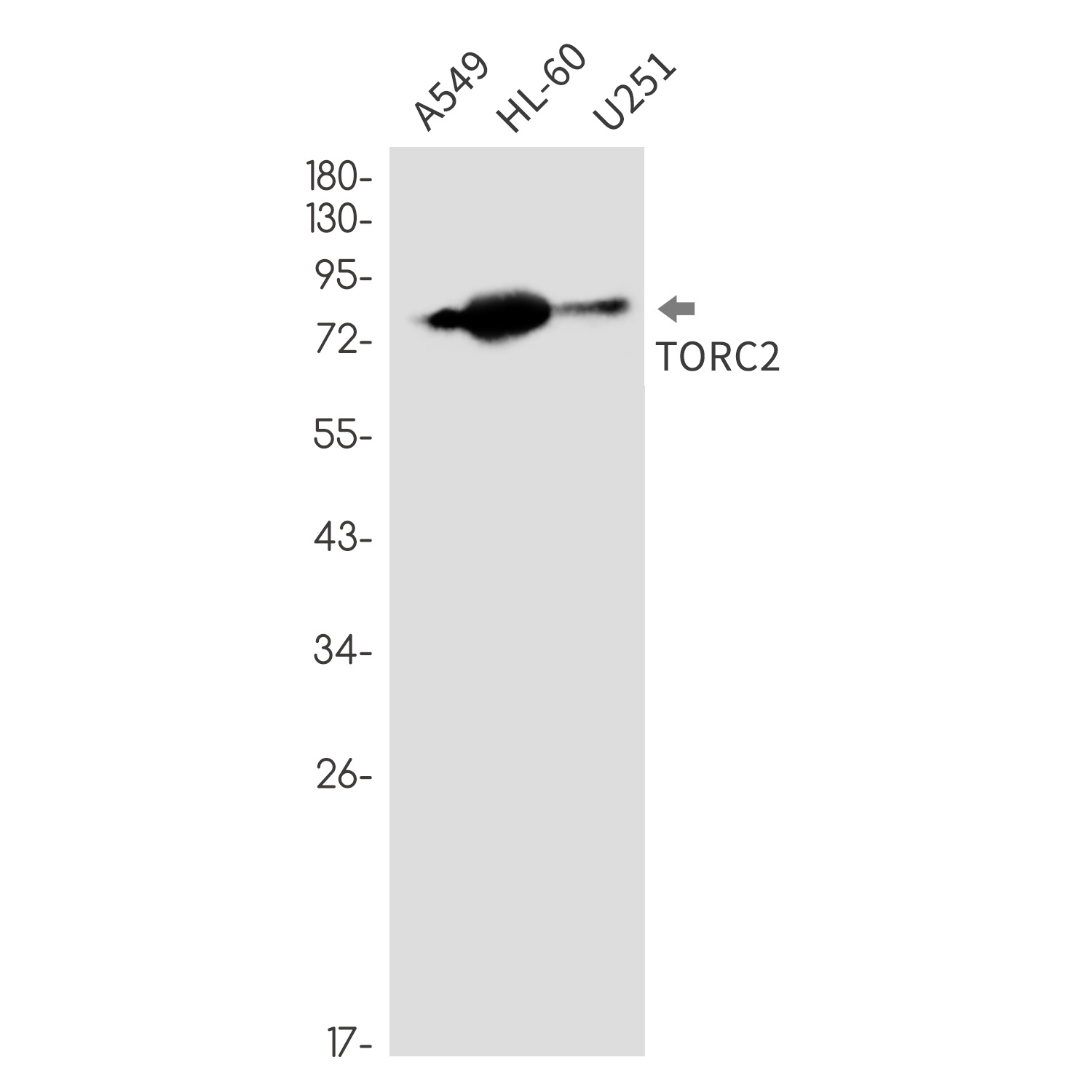 CREB Regulated Transcription Coactivator 2 Rabbit mAb