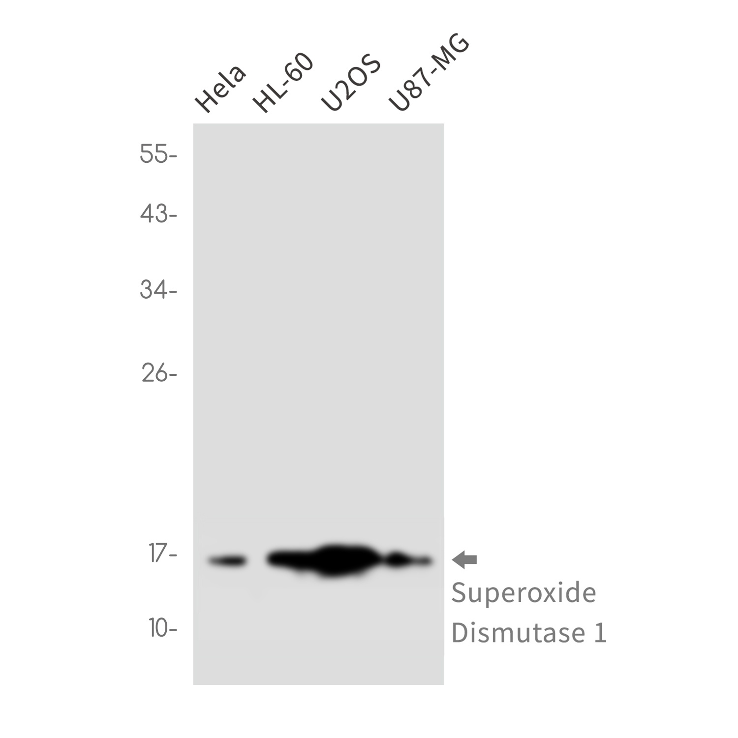 Superoxide Dismutase 1 Rabbit Monoclonal Antibody