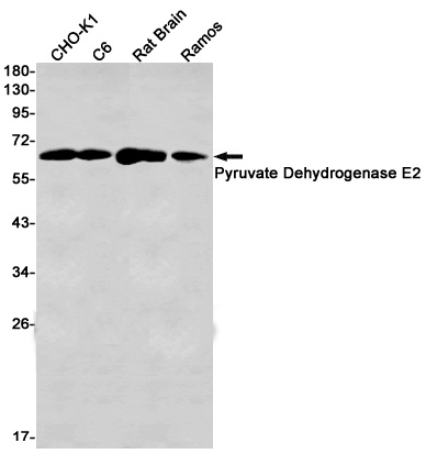 [KD] Pyruvate Dehydrogenase E2 Rabbit mAb