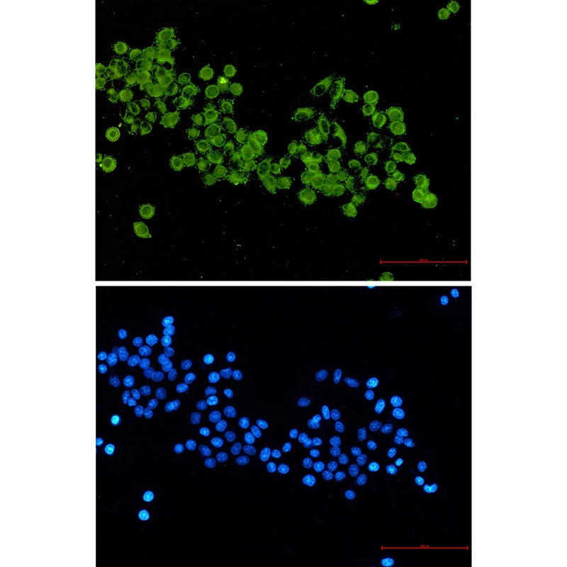[KD] Pyruvate Dehydrogenase E2 Rabbit mAb