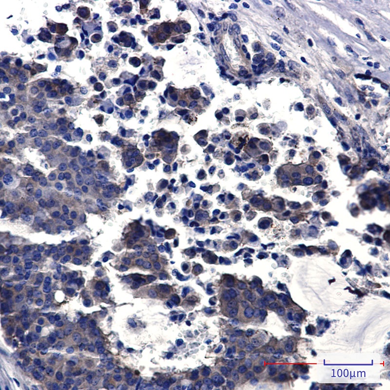 PREPL Antibody