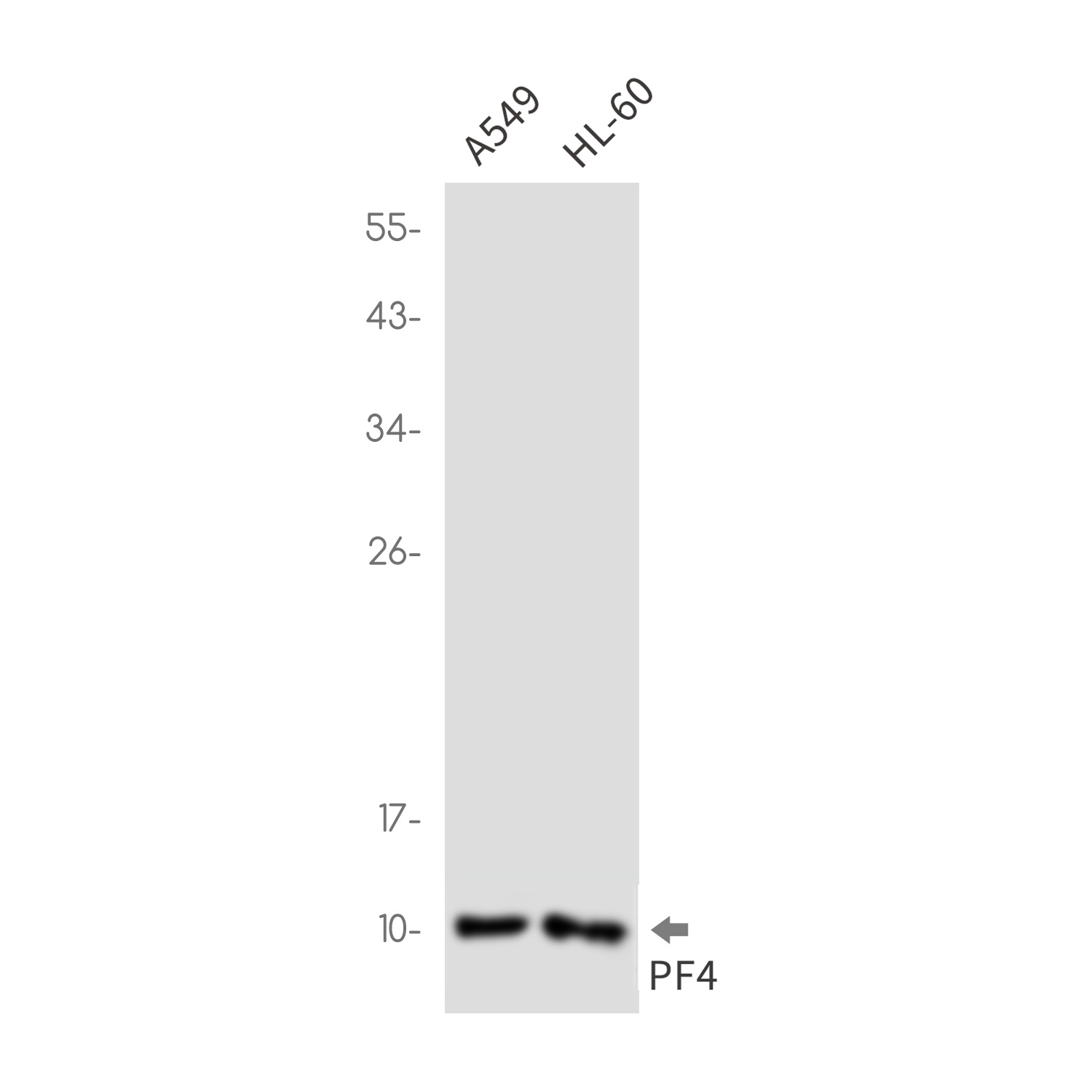 PF4 Rabbit mAb