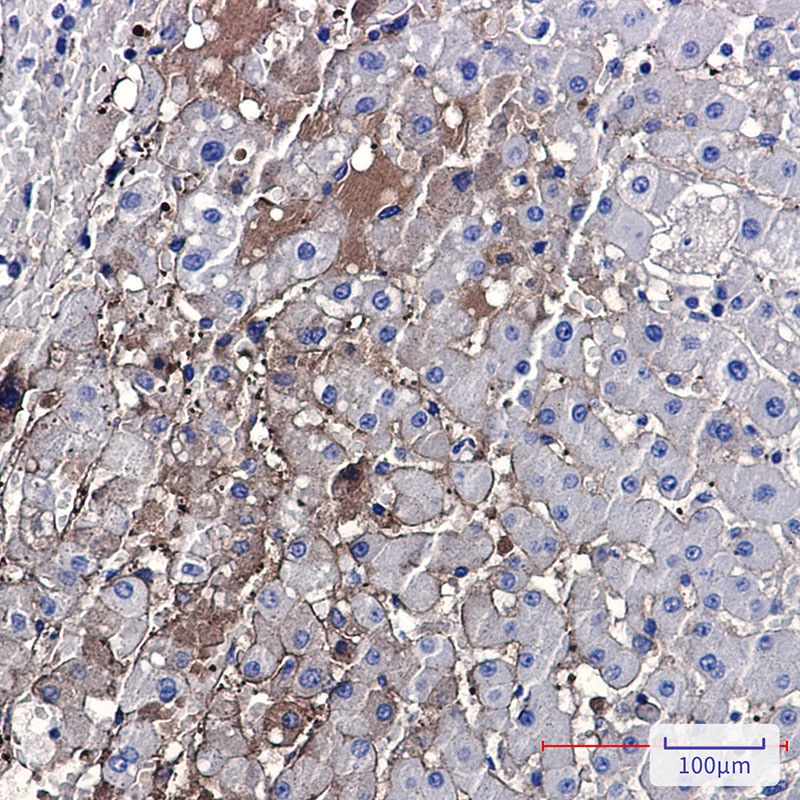 PF4 Rabbit mAb