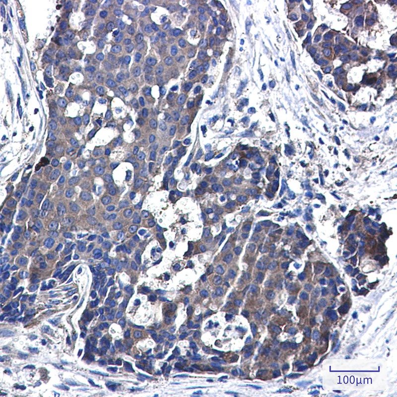 NME3 Antibody