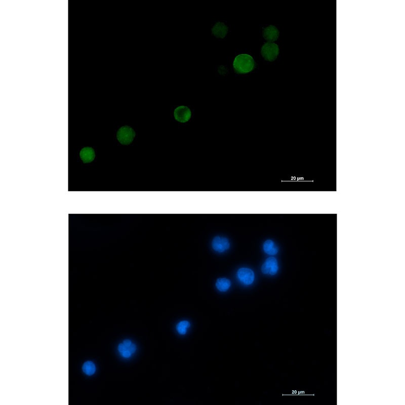 [KD] MCAK Rabbit mAb