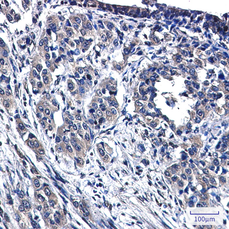 MAP3K4 Antibody