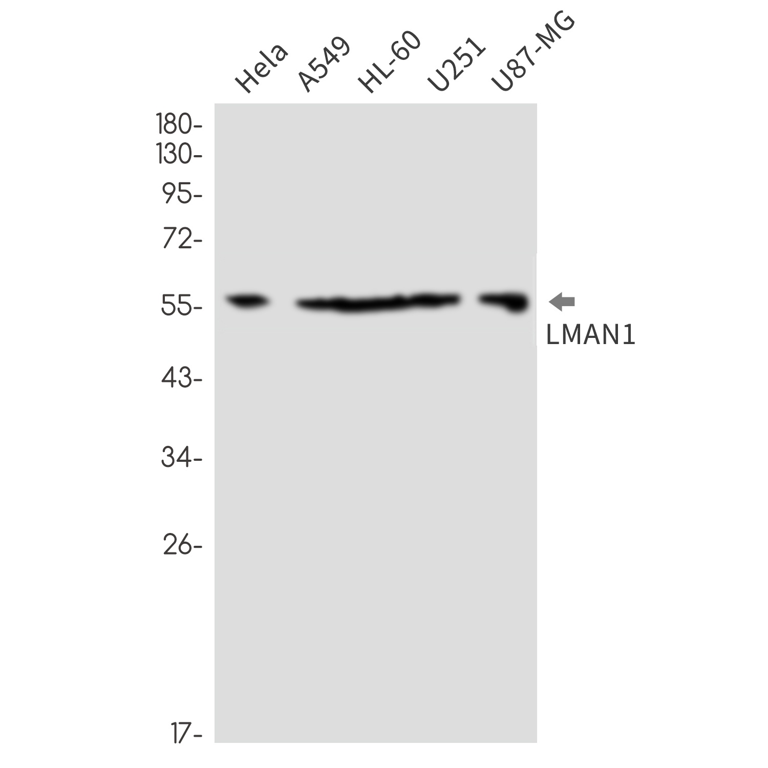 LMAN1 Rabbit mAb