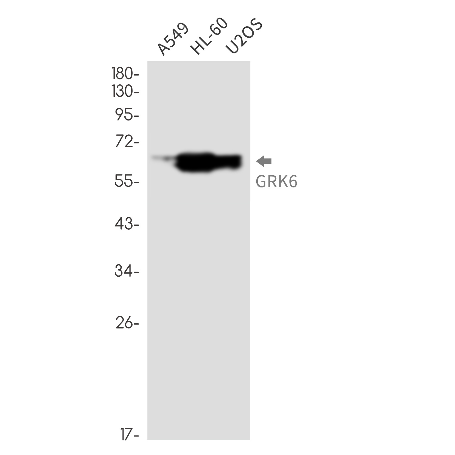 [KO] GRK6 Rabbit mAb