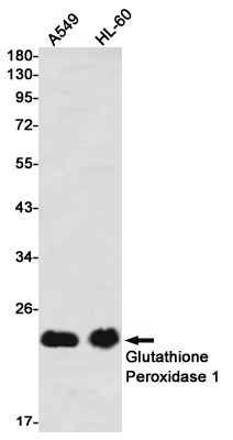 [KO] Glutathione Peroxidase 1 Rabbit mAb