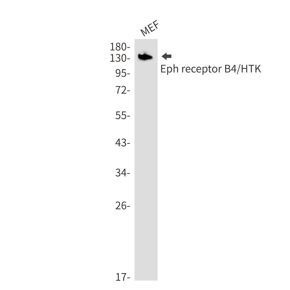 [KO] Ephrin Receptor B4 Rabbit mAb