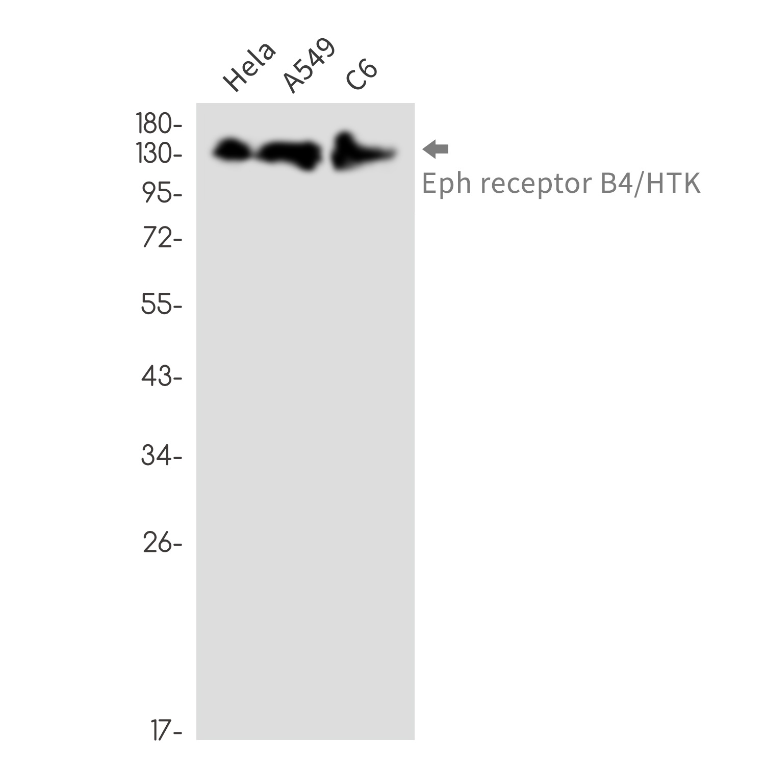 [KO] Ephrin Receptor B4 Rabbit mAb