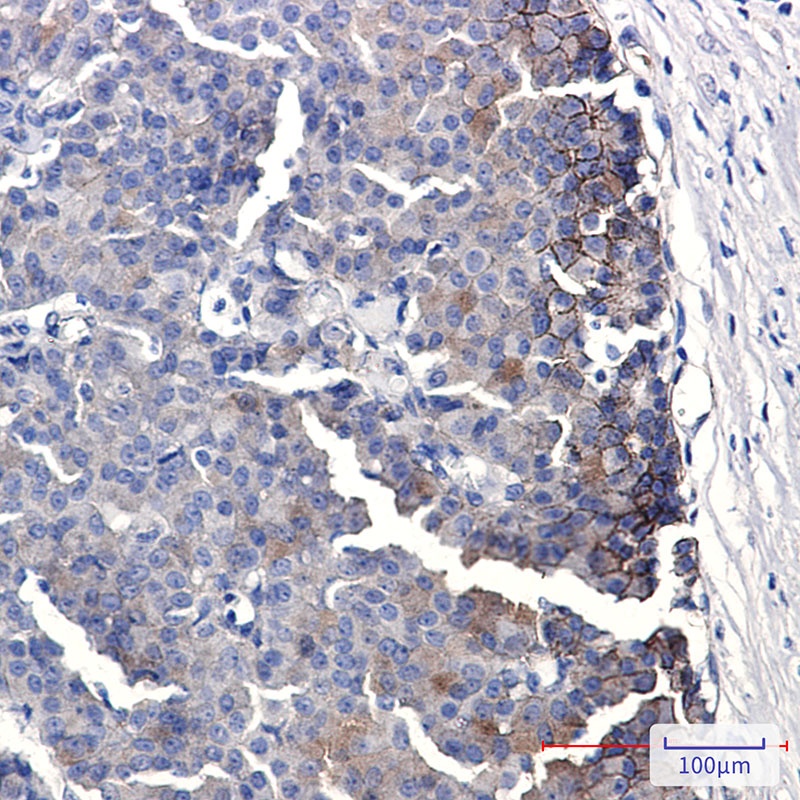 [KO] Ephrin Receptor B4 Rabbit mAb