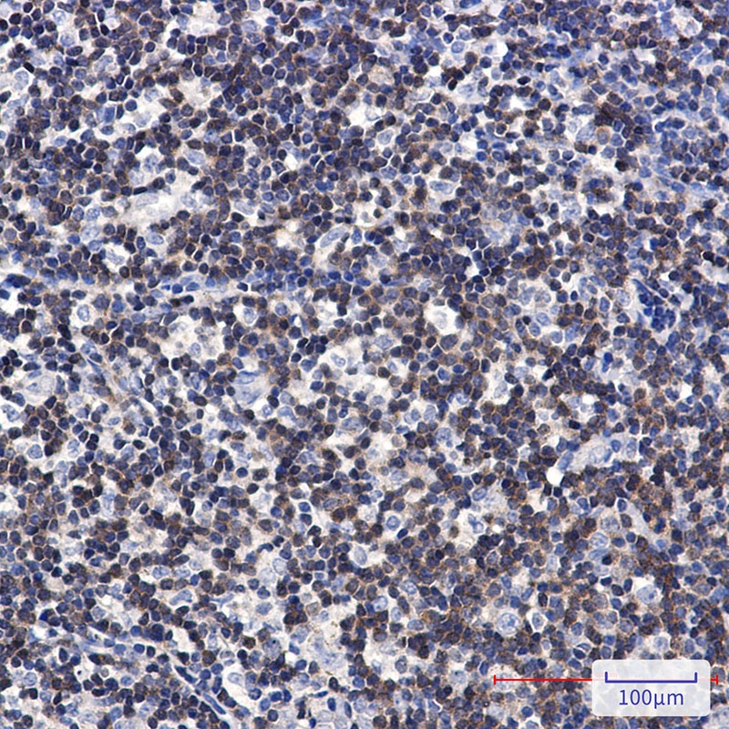 DGKA Rabbit mAb