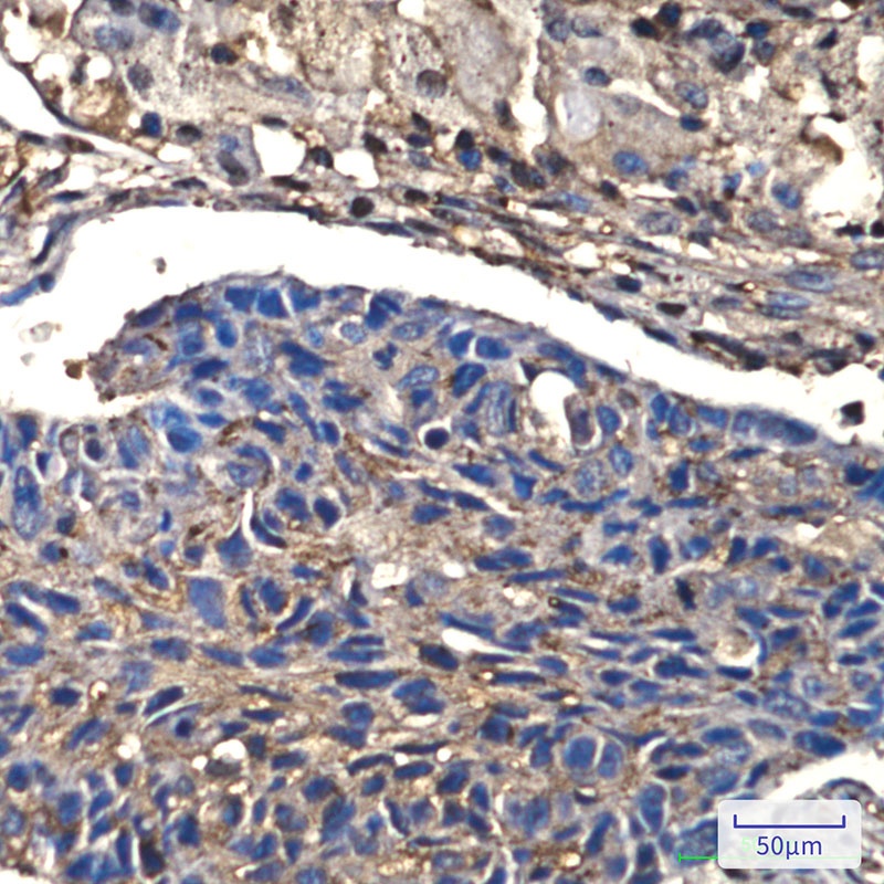 [KO] Cofilin Rabbit mAb