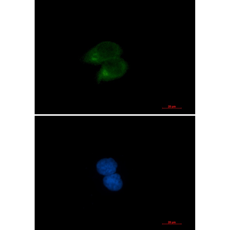 CLSTN1 Rabbit Monoclonal Antibody