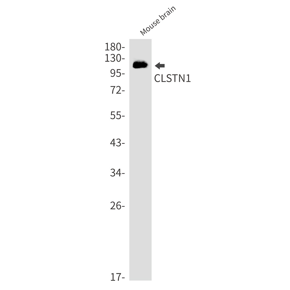 CLSTN1 Rabbit Monoclonal Antibody