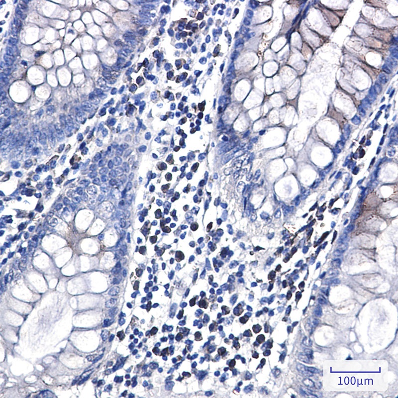 CLSTN1 Rabbit Monoclonal Antibody