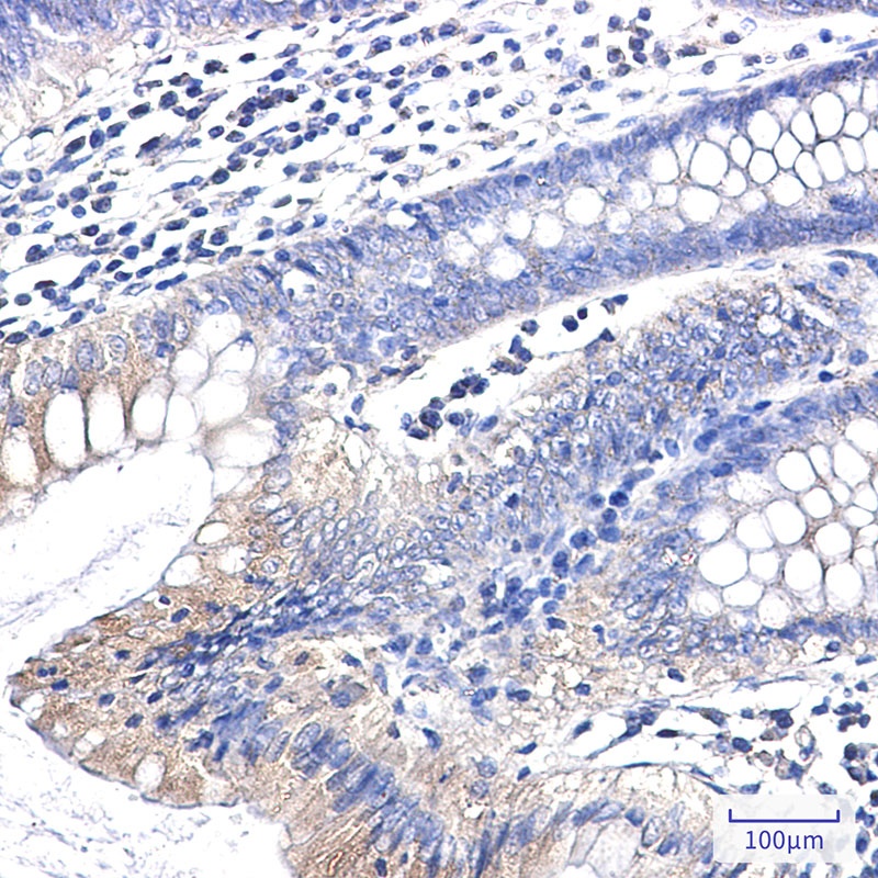 Clathrin Heavy Chain Rabbit mAb