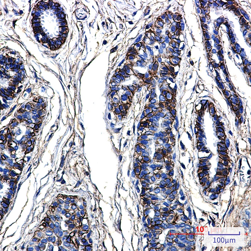 CD99 Rabbit Monoclonal Antibody