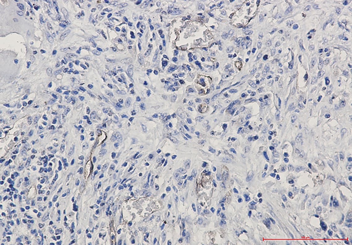 CD105 Rabbit mAb