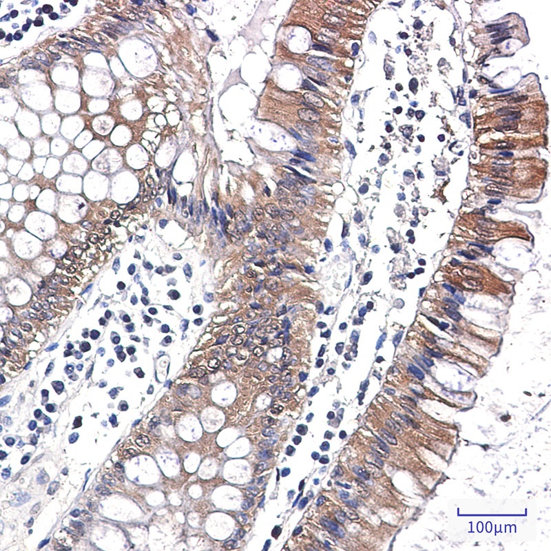 Caspase 7 Rabbit mAb