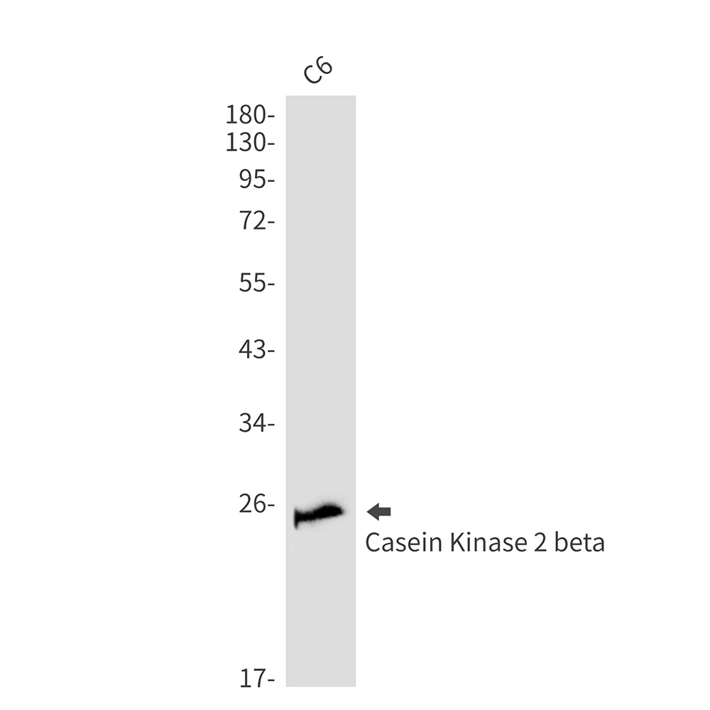 Casein Kinase 2 beta Rabbit mAb
