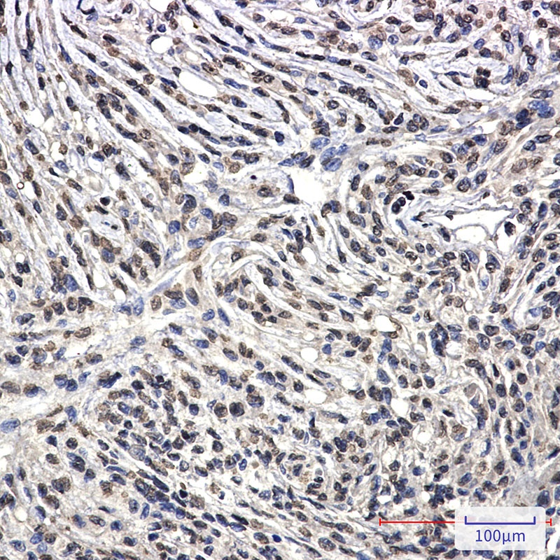 Bcr Rabbit mAb