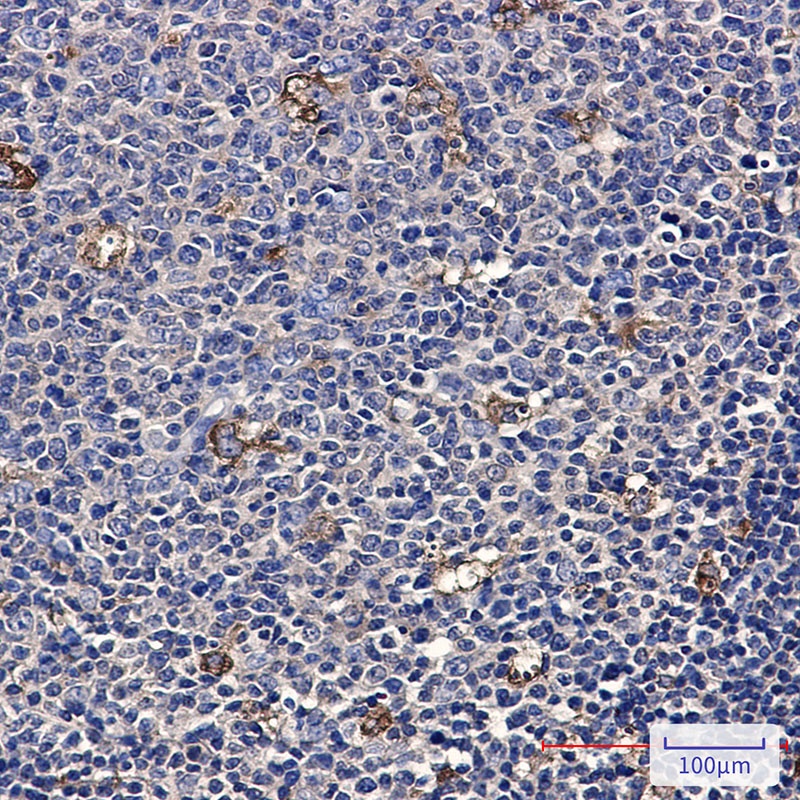 ATP6V1A Rabbit mAb