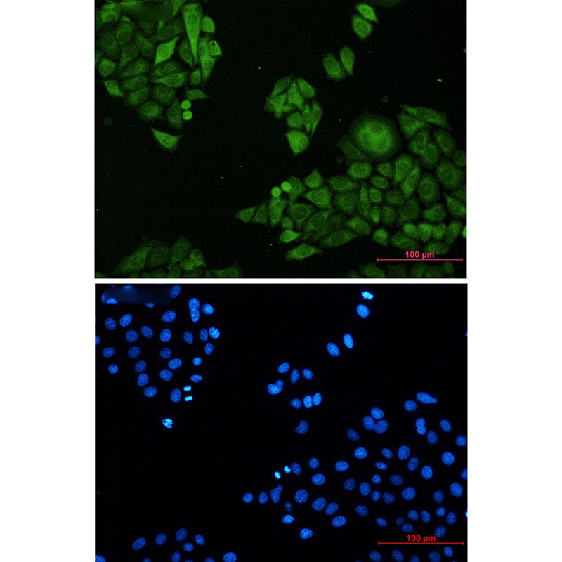 [KO] Annexin 4 Rabbit mAb