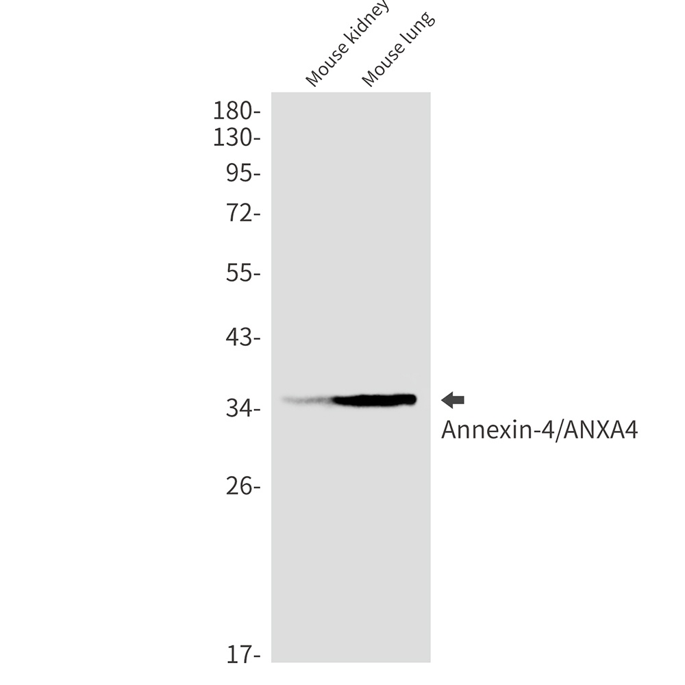 [KO] Annexin 4 Rabbit mAb
