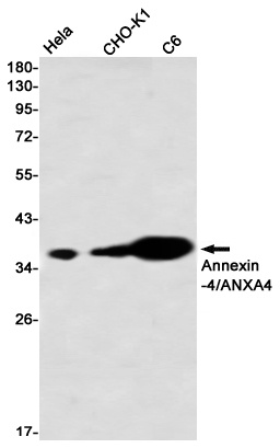 [KO] Annexin 4 Rabbit mAb