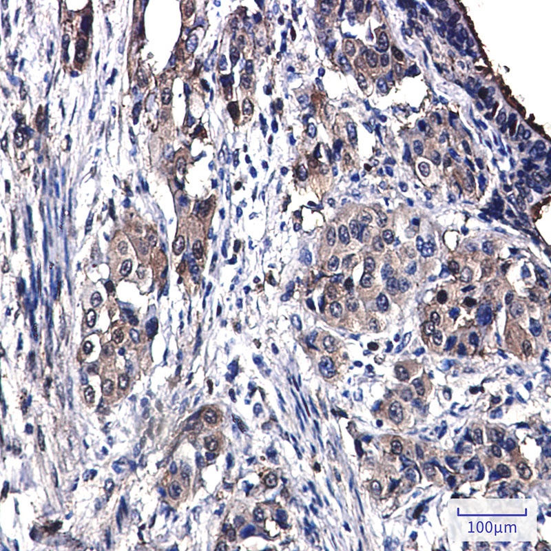 [KO] Annexin 4 Rabbit mAb