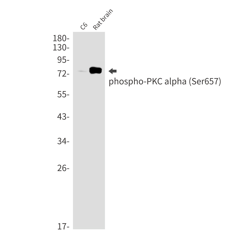 [KD] Phospho-PKC alpha (Ser657) Rabbit mAb
