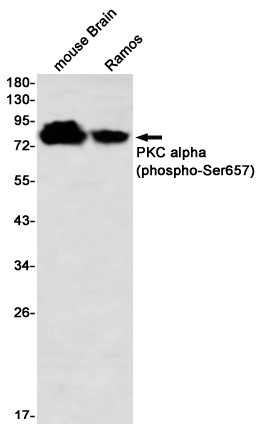 [KD] Phospho-PKC alpha (Ser657) Rabbit mAb