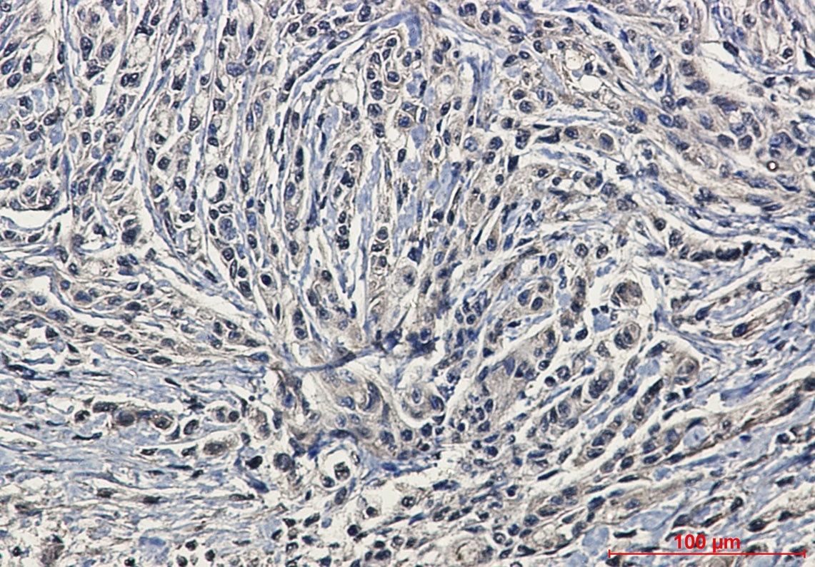 [KD] Phospho-PKC alpha (Ser657) Rabbit mAb