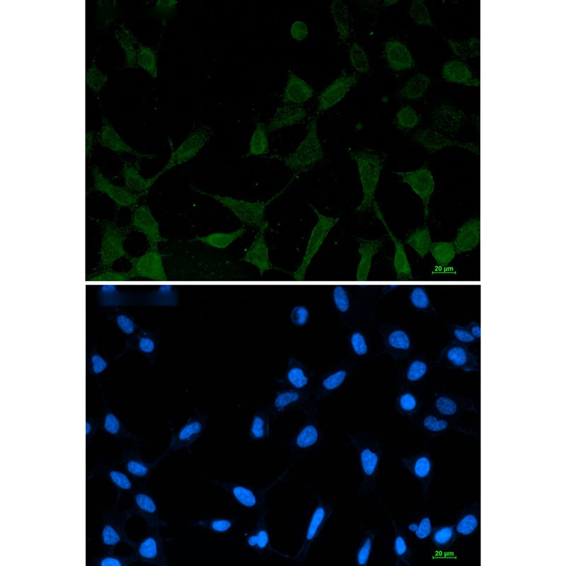 [KO] Phospho-NDRG1 (Ser330) Rabbit mAb